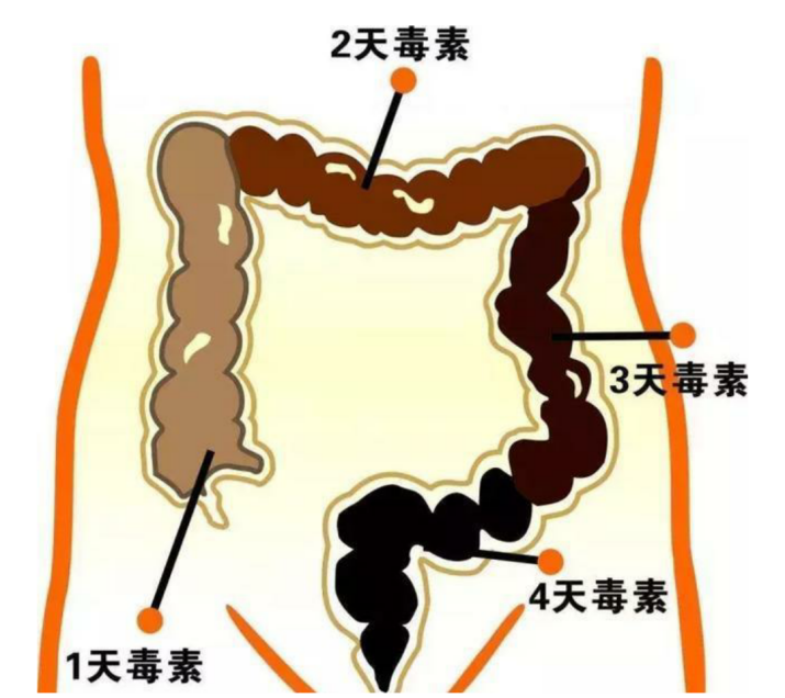 建议，惊人！女子便秘困扰二十年，医生竟从其腹中取出巨型结肠，背后真相令人震惊！